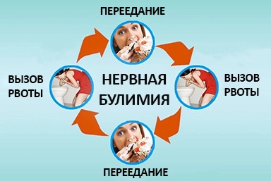 Лечение булимии в Петровске